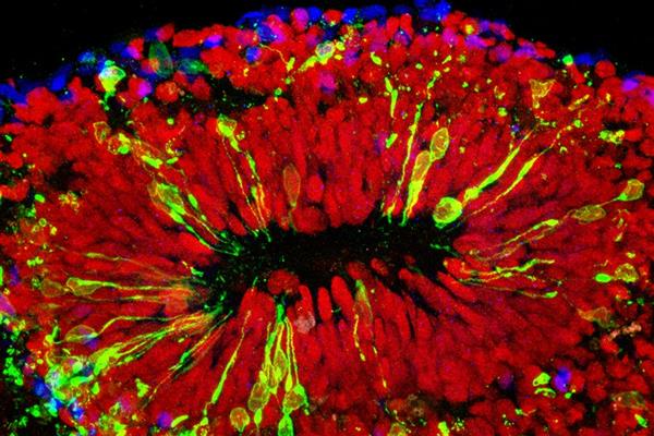 科學家攻克Zika病毒 高中生攜3D打印來幫忙

Zika病毒,3D打印醫(yī)療行業(yè),3D打印材料價格,3D打印技術(shù),3D打印材料,3D打印成本,3D打印價格
