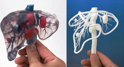 簡述現階段醫用3D打印設備和打印材料的相關進展_e鍵3D打印服務