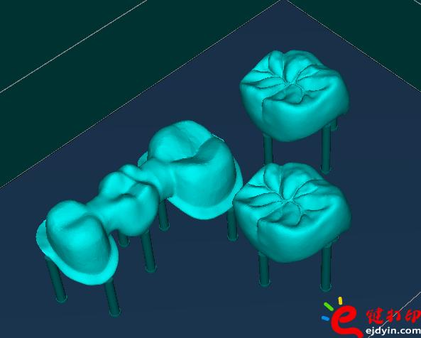 3d打印牙齒價(jià)格,3d打印牙齒模型,3d打印牙齒臨床了嗎,3d打印牙齒價(jià)格表,3d打印牙齒能用多久 3d打印牙齒價(jià)格,3d打印牙齒模型,3d打印牙齒臨床了嗎,3d打印牙齒價(jià)格表,3d打印牙齒能用多久