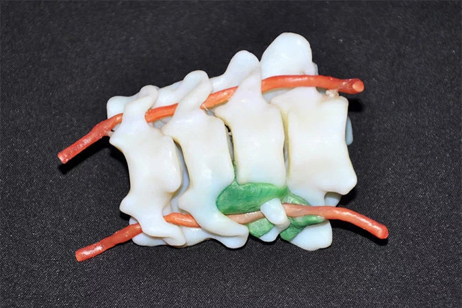 全彩3D打印應用于醫療行業的3d打印案例