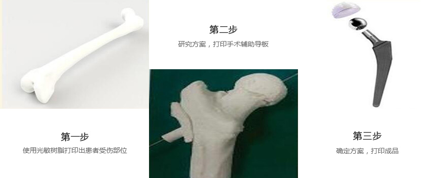 股骨金屬植入物3d打印制作流程